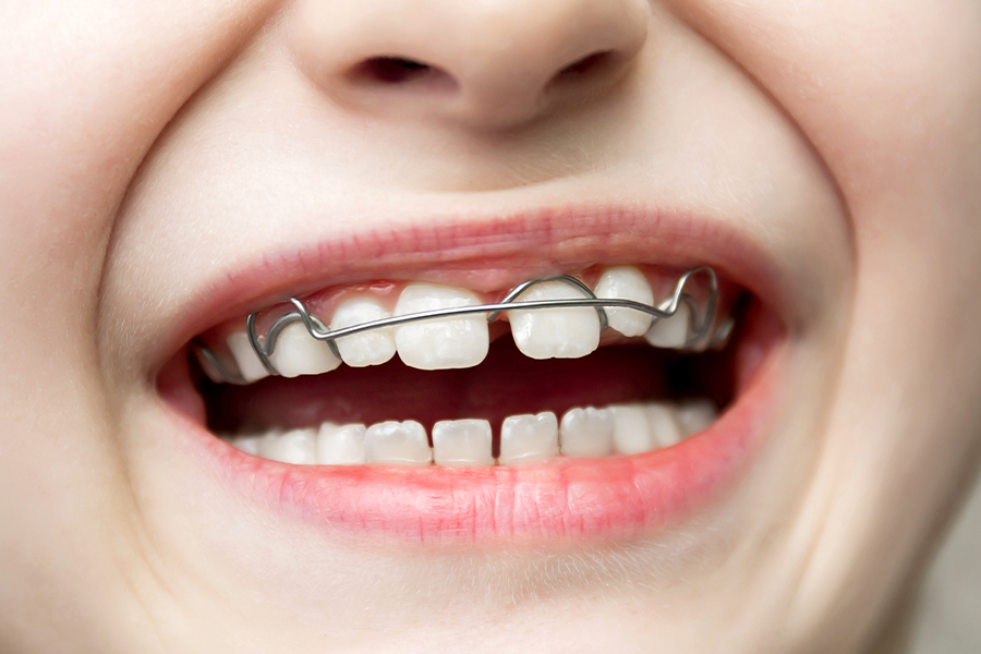 二期治療について