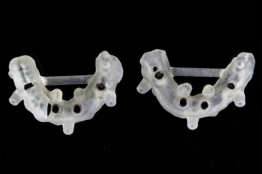 検査・診断・サージカルガイド
の作製